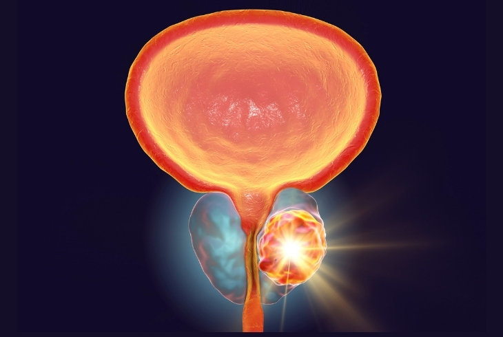 Advanced Urocare Centre
