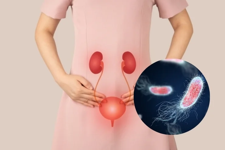 Advanced Urocare Centre
